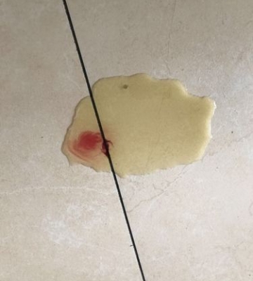 狗狗尿完尿血怎么回事